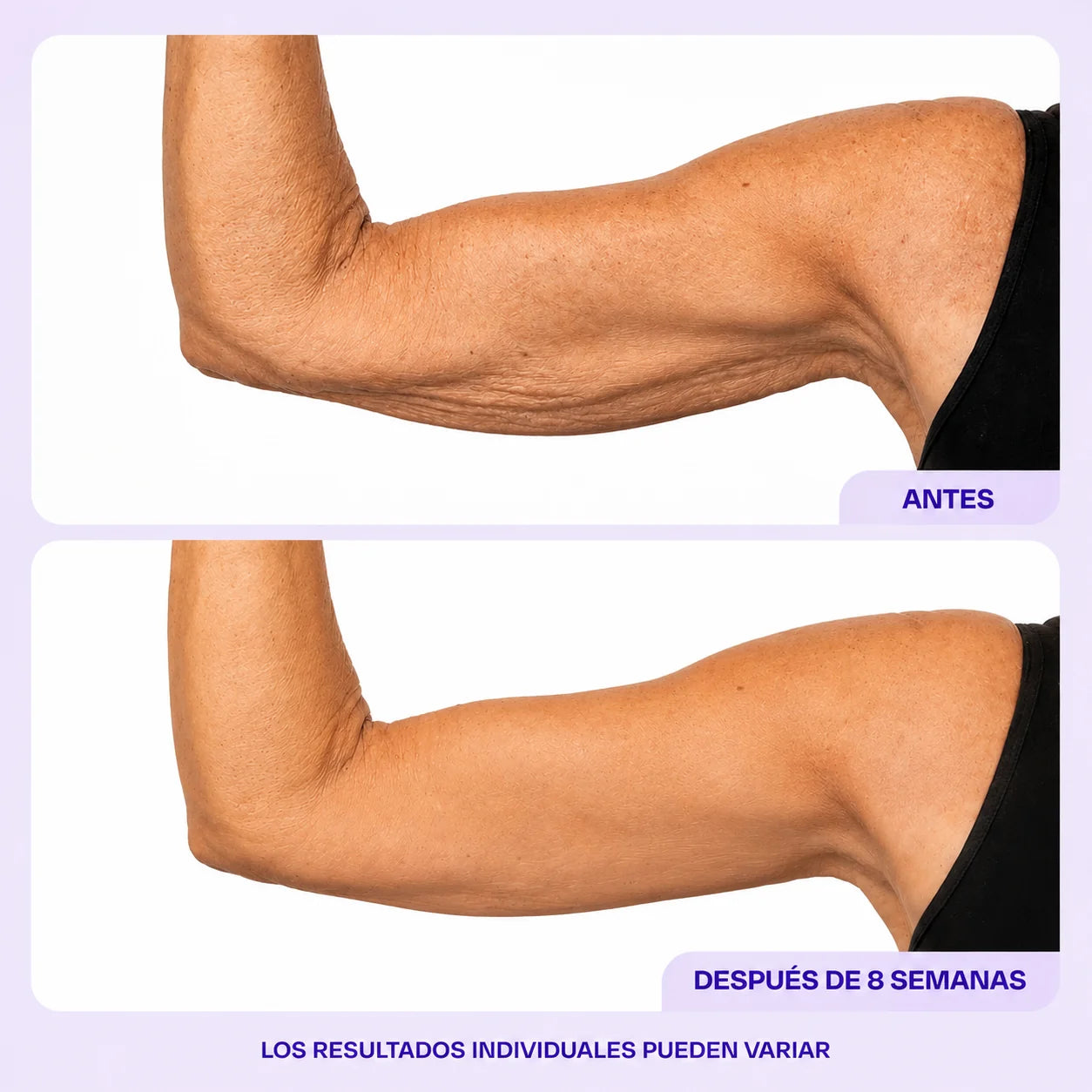 Nevaria Sculpt & Tone Crema Reafirmante para Brazos