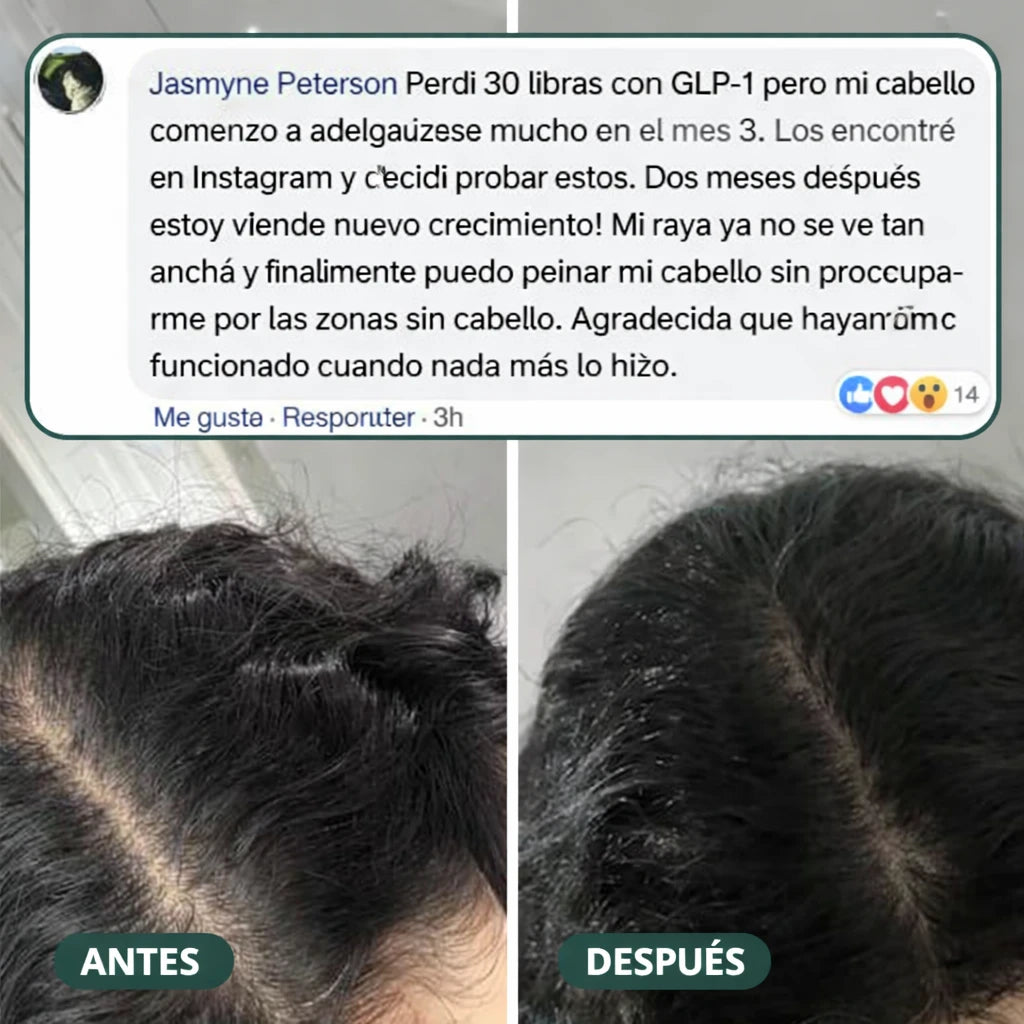 Gomitas para revitalizar el cabello