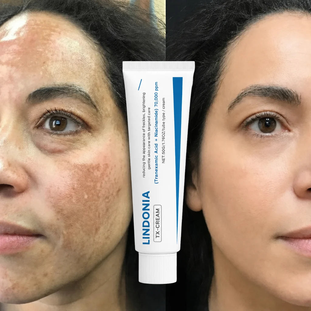 Landoni® Corrector de Manchas